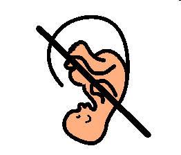 avortement